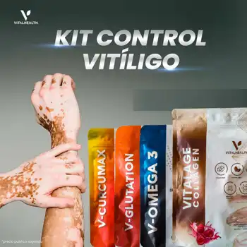 Kit para tratamiento del vitíligo con suplementos VitalHealth. Incluye V-Curcumax, V-Glutation, V-Omega 3 y Vitalage Collagen. Imagen de brazos con vitíligo mostrando efecto despigmentante. Fórmula antioxidante y regeneradora para apoyar el equilibrio inmunológico y la salud de la piel.